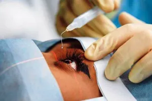 मोतियाबिंद के ऑपरेशन में छत्तीसगढ़ का यह जिला आया देश में अव्वल, केंद्र ने की तारीफ