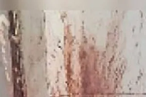 सीतापुर: जुर्माना दरकिनार, अस्पताल की दीवारों पर दाग बरकरार, बोले सीएमएस- अब फिर से शुरू की जाएगी कार्रवाई