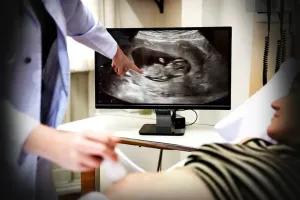 हल्द्वानी: महिला अस्पताल में अल्ट्रासाउंड शुरू होते ही मरीजों की लगी कतार