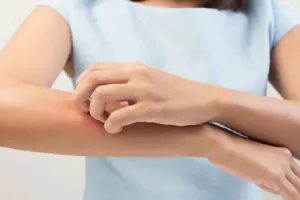 ठंड के मौसम में त्वचा पर खुजली, खुश्की और पपड़ी की स्थिति... कैसे करें उपचार ?