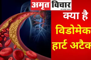 Widowmaker Heart Attack : क्या है विडोमेकर हार्ट अटैक? जानिए इसके लक्षण और कैसे करें देखभाल
