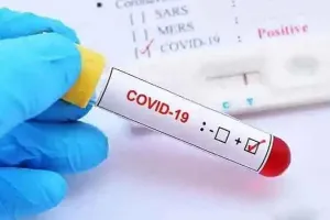 मुरादाबाद : महिला चिकित्सक व स्वास्थ्यकर्मी सहित 14 और कोरोना संक्रमित