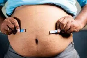 बहुत मोटे हो रहे भारतीय, 50 प्रतिशत की आई बढ़ोतरी : अपोलो की वार्षिक रिपोर्ट 