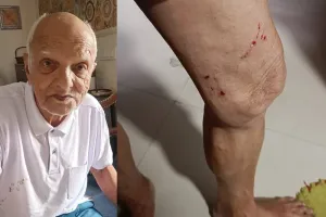 लखनऊ: बच्चे को बचाने गए बुजुर्ग को कुत्तों ने नोंचा, थम नहीं रहा आतंक, बच्चों ने निकला किया बंद