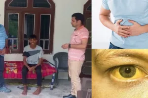 हिमाचल प्रदेश में हमीरपुर के 10 गांवों में फैला पीलिया, 44 लोग संक्रमित