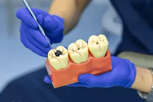 देहरादून: डेंटल क्लिनिक में कैसे पहुंची हेयर ट्रांसप्लांट की दावा? जानिए इधर 