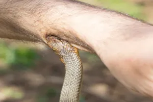 रायबरेली : सर्पदंश की घटनाओं को लेकर प्रशासन अलर्ट