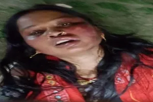 प्रयागराज : ससुराल वालों ने विवाहिता के गले को फंदे से कसा, बेरहमी से पीटा - जान बचाकर भागी  