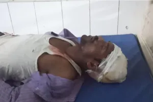 बहराइच : शटरिंग मशीन के नीचे दब कर सगे भाई हुए घायल