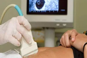 बरेली: स्वास्थ्य विभाग के अपने ही गर्भ में रेडियोलॉजिस्ट नहीं... महिलाओं की जांच कैसे करे