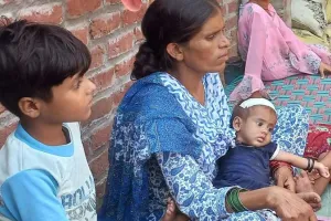 रामपुर: आंगन में सो रही बच्ची को उठा ले गया बंदर, छत से फेंका, सिर में आए 10 टांके 