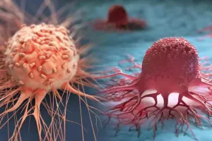 50 साल से कम उम्र में बढ़ रहे हैं कैंसर के मामले, लेकिन कारण अज्ञात 