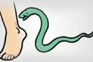 रामपुर: मिलकखानम में सर्पदंश से महिला की मौत, मचा कोहराम