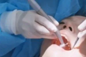 लखनऊ : एलाइनर आएगा काम अब टेढ़े दांतों के नहीं लगाने होंगे तार