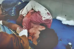 बहराइच: करछुला से हमला कर ग्रामीण को किया लहूलुहान, जिला अस्पताल में चल रहा इलाज