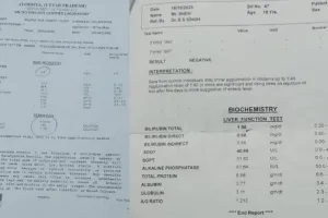 अयोध्या: किस मर्ज की दवा करे मरीज..., सरकारी व निजी पैथालॉजी की जांच में रिपोर्ट में अंतर