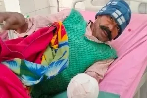 मुरादाबाद : ट्रेन की चपेट में आने से किसान का हाथ कटा