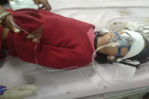 औरैया: कुत्ते के काटने से बच्ची की बिगड़ी हालत, डॉक्टरों ने हायर सेंटर किया रेफेर