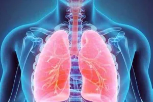 बरेली: एसीएफ अभियान के तहत जिले में 90 से अधिक लोग मिले टीबी रोग से ग्रसित 