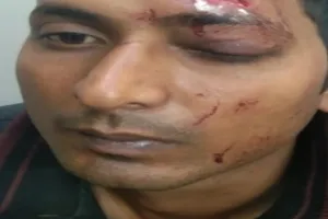 बहराइच : सुबह सीओ और थानाध्यक्ष को सुरक्षा के लिए दिया पत्र, रात में हो गया हमला