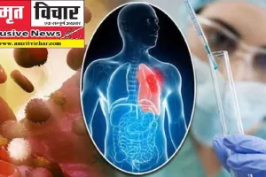 Exclusive: गुटखा, सिगरेट न शराब...फिर भी कैंसर के हुए शिकार, जेके कैंसर संस्थान में पीड़ित मरीजों की भरमार, ऐसे केस आ रहे सामने