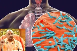 लखनऊ: यूपी में 'टीबी' ने तोड़ा दम, प्रदेश की 33 फीसदी पंचायतों को जानलेवा रोग से मिली मुक्ति!, सीएम के प्रयास ला रहे रंग!