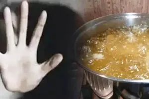 रुद्रपुर: मामूली विवाद के चलते महिला पर फेंका खौलता हुआ तेल