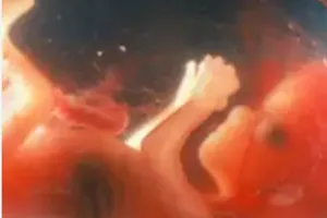 रुद्रपुर: रेलवे मार्ग खाली भूखंड में मिला चार माह का भ्रूण