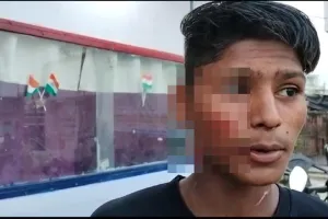 बहराइच: गेंद उठाने को कहा तो किशोर पर युवक ने ब्लेड से किया हमला