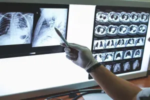 श्रावस्ती: टीबी अस्पताल में लगी एक्स-रे मशीन लंबे अरसे से खराब, मरीजों को लगानी पड़ रही घंटों लाइन 