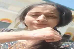 उन्नाव: प्रधानाध्यापिका विद्यालय में करा रही थी फेशियल, सहयोगी शिक्षिका ने मना किया तो दांत से काट कर किया लहूलुहान