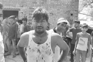 सुलतानपुर: संदिग्ध परिस्थिति में पटाखा कारोबारी के घर लगी आग, पिता-पुत्र झुलसे, बाइक व साइकिल जली 