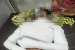 सीतापुर: शादी समारोह में ज़िंदा जला गया युवक, गंभीर हालत में ट्रामा सेंटर में भर्ती 