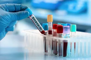 हल्द्वानी: बिना डिग्री के पैथॉलोजी में लैब में सैंपल ले रहा था कर्मचारी