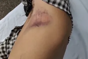 लखनऊ के बाद अब अंबेडकरनगर में पुलिस की गुंडागर्दी! युवक को कमरे में बंद कर बेरहमी से पीटा, अस्पताल में भर्ती