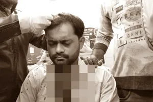 बहराइच: पिता-पुत्र ने सर्राफा व्यवसायी पर लोहे की रॉड से किया हमला, केस दर्ज