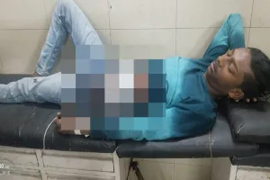 बहराइच: चाकू मारकर दिखाओ.... कहते ही युवक ने दोस्त पर किया हमला, हालत गंभीर, जानें पूरा मामला