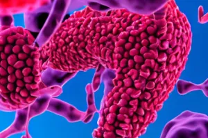 50 फीसदी लोगों में लिवर सिरोसिस का कारण एल्कोहल, नहीं रखा ध्यान तो हो जाएगी गड़बड़