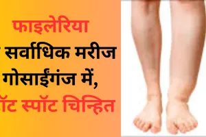 फाइलेरिया के सर्वाधिक मरीज गोसाईंगंज में, हॉट स्पॉट चिन्हित