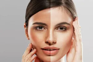 भोजन और दवाएं बदल सकती हैं त्वचा का रंग, कई बार स्थायी रूप से भी 