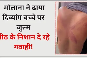 Bareilly: मदरसे की दीवारों में गूंजा दर्द! मौलाना ने दिव्यांग बच्चे को बुरी तरह पीटा...पीठ के निशान दे रहे गवाही