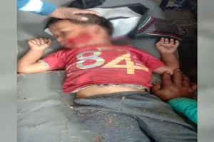 बरेली: कुत्ते ने मासूम बच्चे पर किया हमला, बुरी तरह नोच डाला मुंह