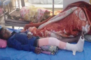 लखीमपुर खीरी: स्कूल वालों पर जबरदस्ती कबड्डी खिलवाने का आरोप, छात्र का टूट गया पैर