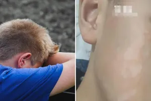 हल्द्वानी: पीटी टीचर ने जड़ा थप्पड़, कक्षा एक के बच्चे का सूजा गाल 