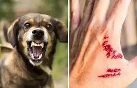 हल्द्वानीः आवारा कुत्तों ने लड़की को किया घायल