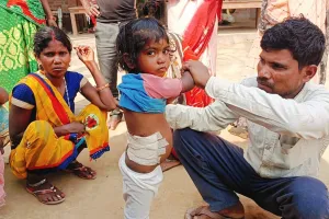 Bahraich : सहेलियों के संग खेल रही बच्ची पर आवारा कुत्तों का हमला