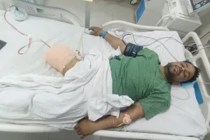 Bareilly: इनामी बदमाश शेरा ने गंवाया दाहिना पैर...मुठभेड़ में गोली लगने से फैला संक्रमण