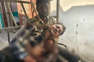 रामपुर: जमीन को लेकर सौतेले भाइयों में झगड़ा, चाकू से किया हमला...ताबड़तोड़ किए वार