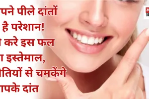 अपने पीले दांतों से है परेशान! तो करे इस फल का इस्तेमाल, मोतियों से चमकेंगे आपके दांत