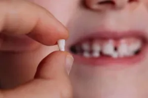 बरेली: आप भी चाहते है सही तरीके से बोले आपका बच्चा, दूध के दांतों का ऐसे रखें ख्याल